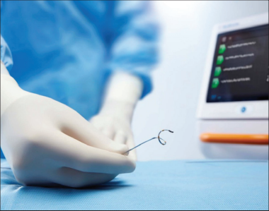  RDN | 經腎動脈去交感神經術——高血壓微創(chuàng)介入治療